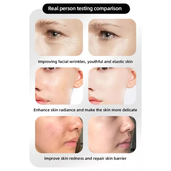 Photon Foryngende Ansigtspleje LED-maske